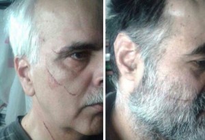 Political prisoners Saeed Madani (L) and Saeed Razavi Faqih with scars on their faces (Photo Credit: Payvand)